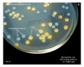 escherichia coli, salmonella enterica on CLED agar